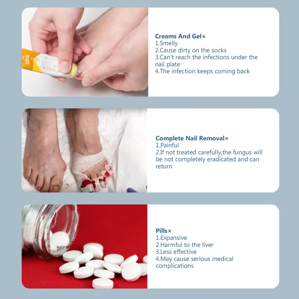 Nail Fungus Laser Treatment Device Dual Wavelength Therapy