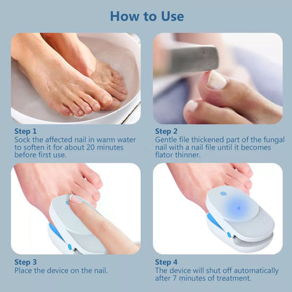 Nail Fungus Laser Treatment Device Dual Wavelength Therapy