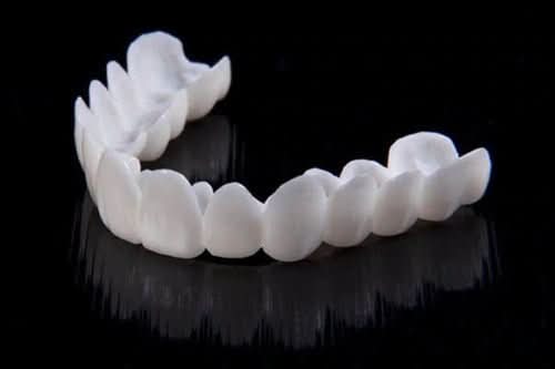 Removable Dental Veneer Prosthesis with White Tooth Appearance