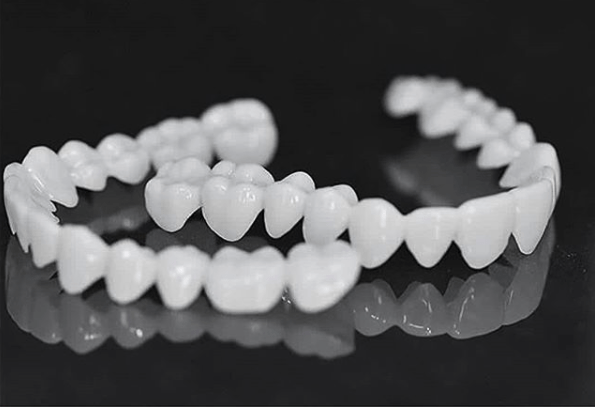 Removable Dental Veneer Prosthesis with White Tooth Appearance