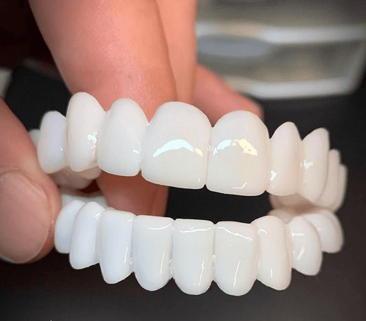 Removable Dental Veneer Prosthesis with White Tooth Appearance